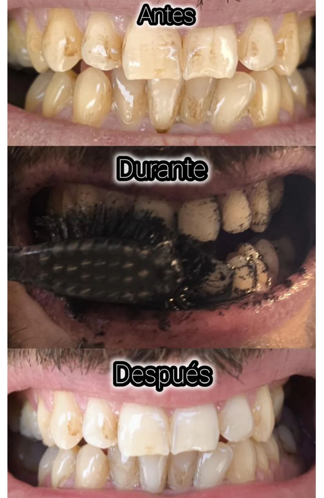 Kit indispensable para los que la tienen clara: Desodorante detox + dientes blancos