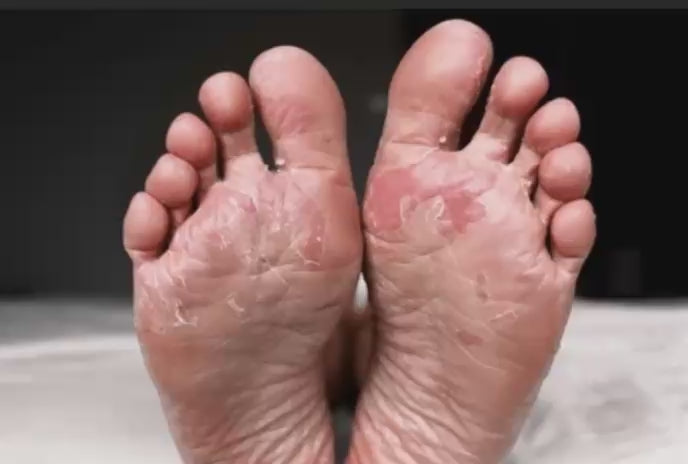 Kit pies de Princesa